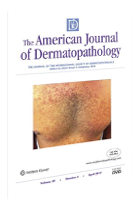 Artigo científico sobre prurigo pigmentosa é capa do American Journal of Dermatopathology